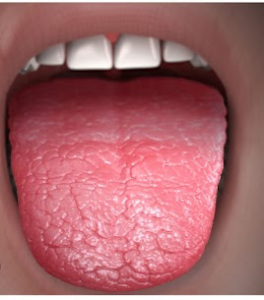 Know About The Dry Mouth ?