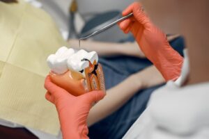 Understanding Dental Caries: What Are the Causes and Symptoms?