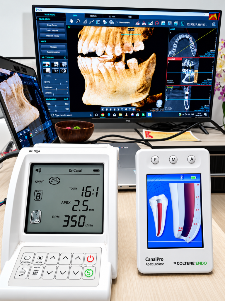 root canal treatment in hinjawadi