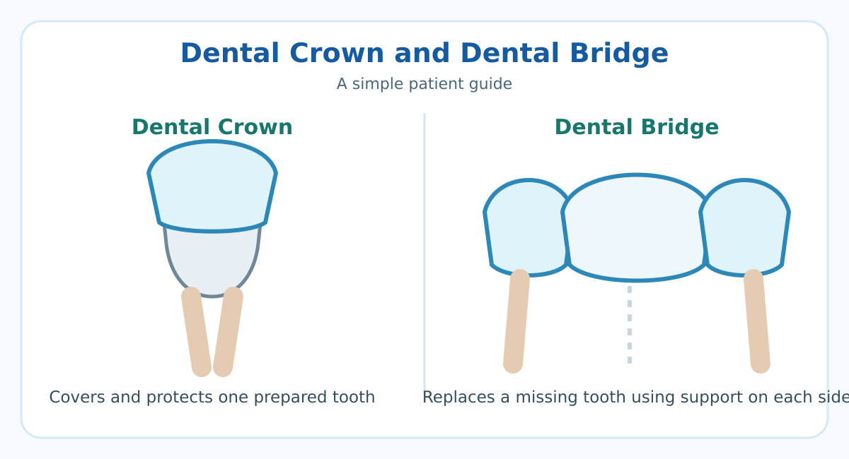 Dental crowns & bridges in Hinjawadi – crown and bridge diagram